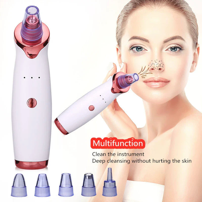 Electric Blackhead Remover