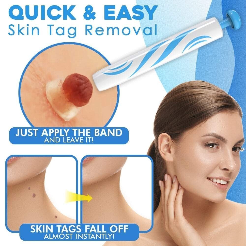 🔥auto micro skin tag remover