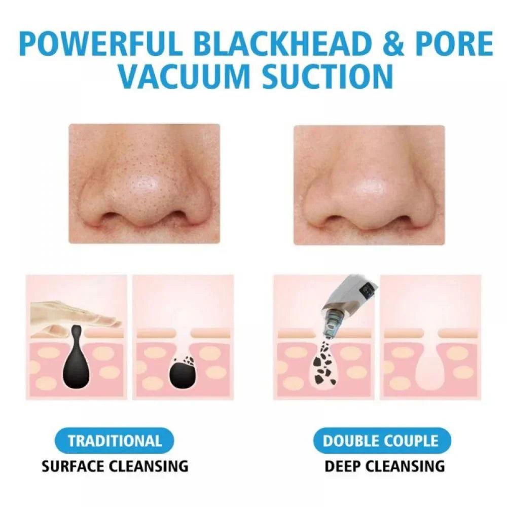 Electric Blackhead Remover