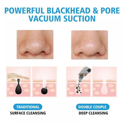 Electric Blackhead Remover