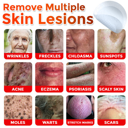 🔥🔥Annual Best-Selling Product - Skin Tag Removal Patches