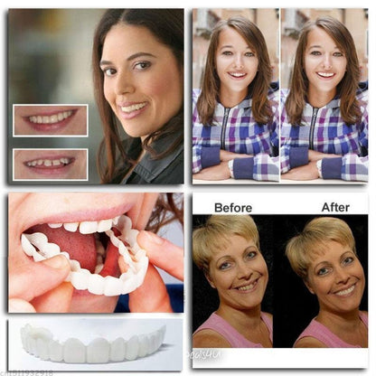 🎉Snap-On Dentures