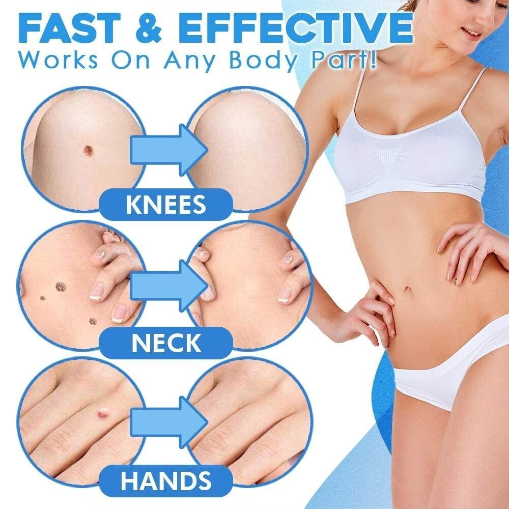 🔥auto micro skin tag remover
