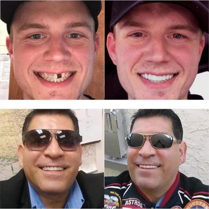 🎉Snap-On Dentures