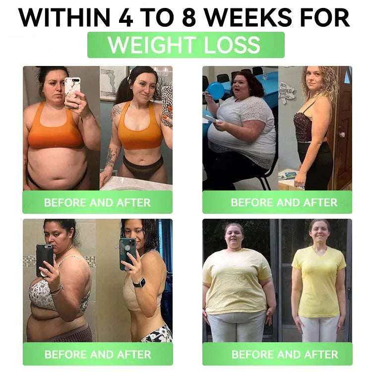 🔥Transdermal slimming patch – once a day, results in 7 days