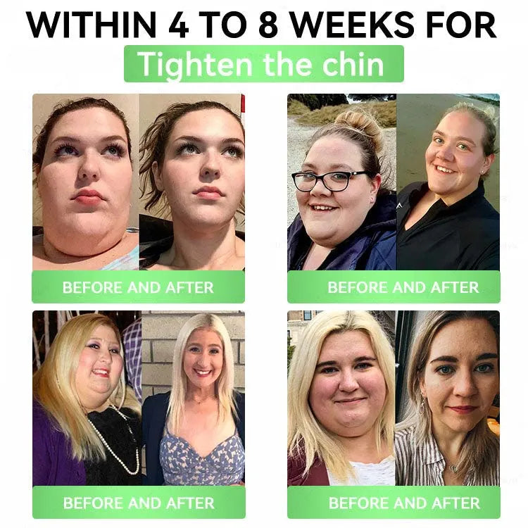 🔥Transdermal slimming patch – once a day, results in 7 days