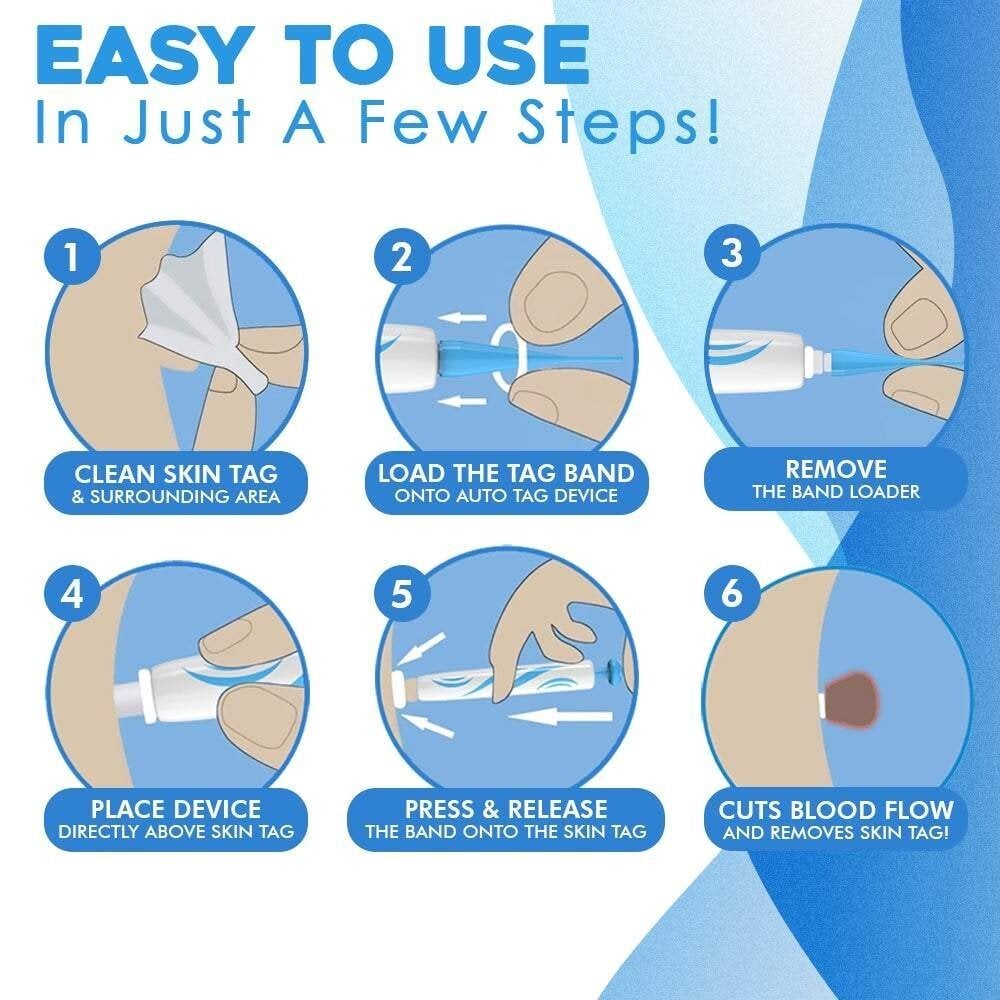 🔥auto micro skin tag remover
