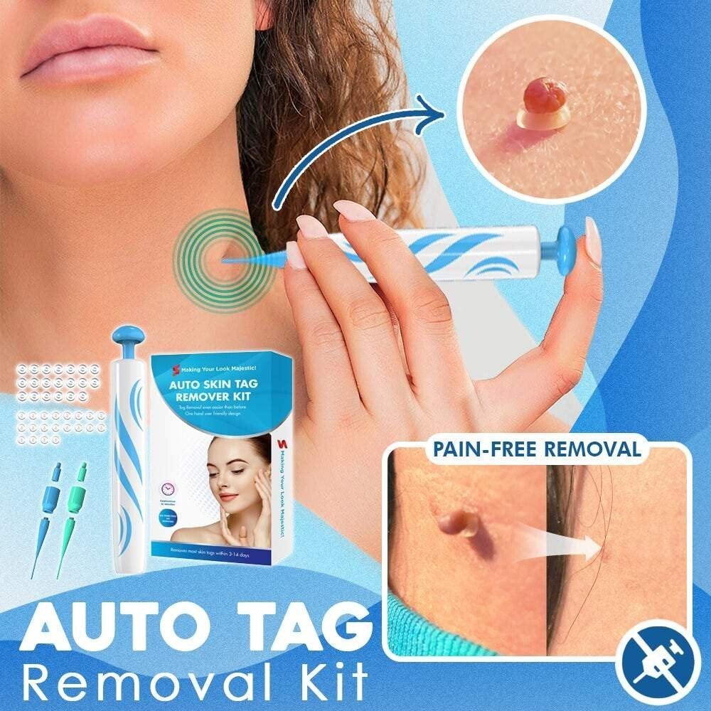 🔥auto micro skin tag remover