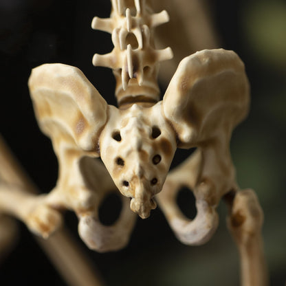 Radiantgrp - WENDIGO SKELETON CURIOSITY CABINET